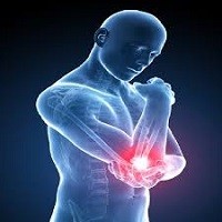 پاورپوینت اختلالات تجمعی ناشی از ترومای اندام فوقانی